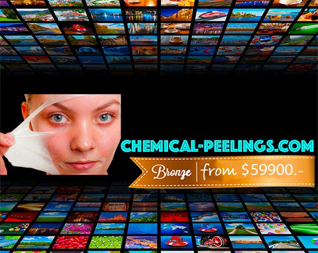 sell-domain-chemicalpeeling-com